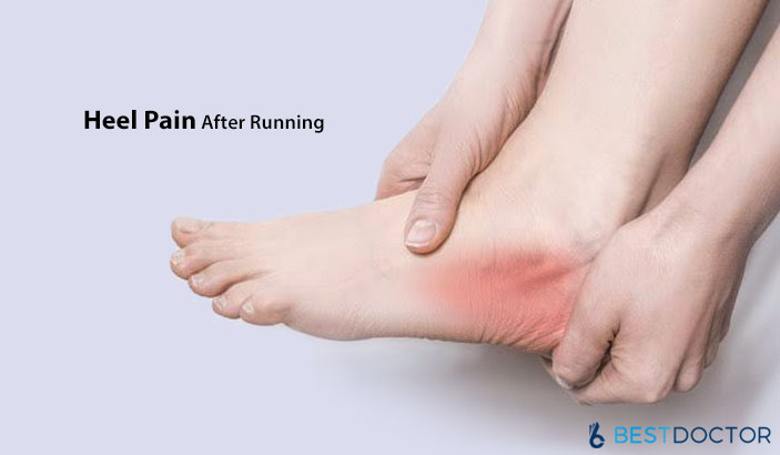 heel hurts after running