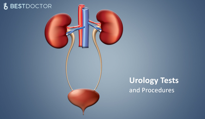 Common Urology Tests For Male And Female